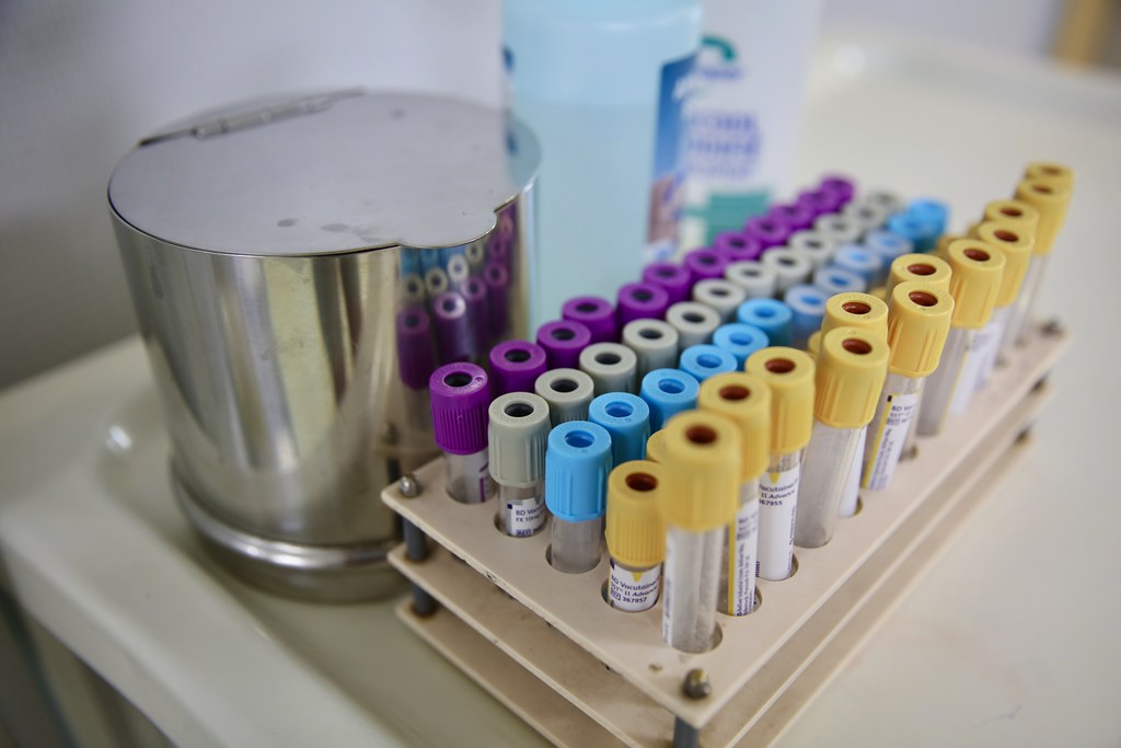 Jedan pozitivan u Istri 